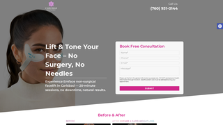 Thumbnail of carlsbadnonsurgicalfacelift.com